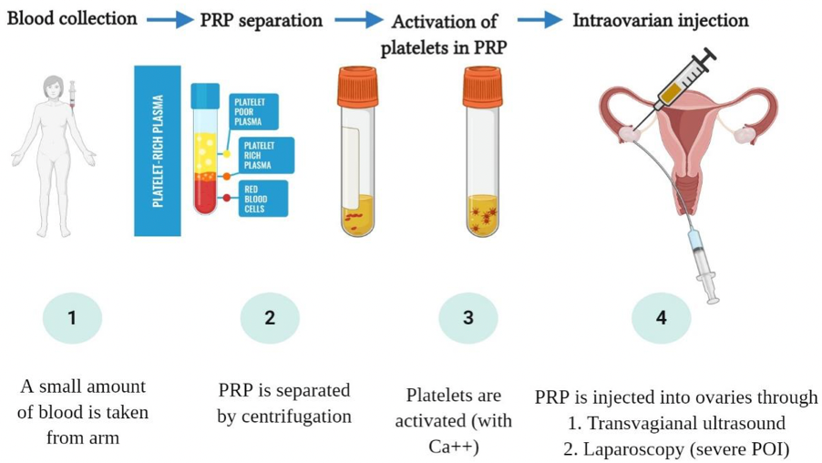 The procedure of PRP preparation and intraovarian injection.
