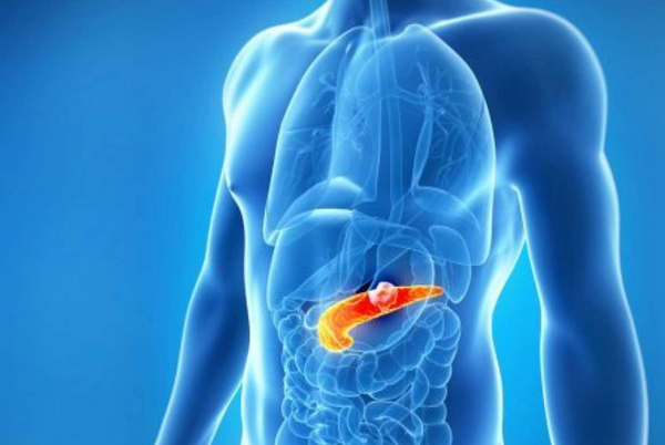 Three-way approach for precision strike against pancreatic cancer