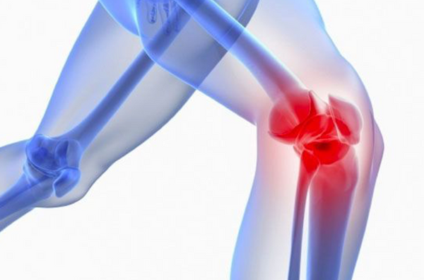 Using ultrasound to catch osteoarthritis in early stages