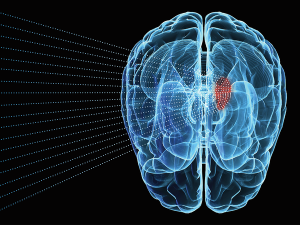 Sonodynamic therapy: is this the new weapon against cancer?