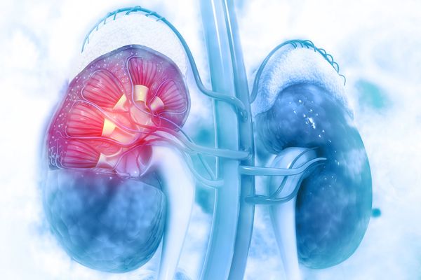 Do we need to be alarmed about kidney disease after COVID-19?