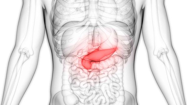 Antibiotics can cut the risk of pancreatic cancer caused by gut bacteria