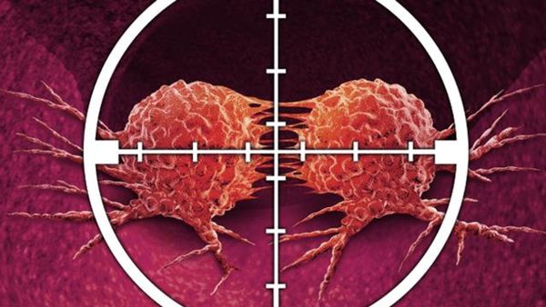 Blocking this key gene could be the switch to turn off major cancers