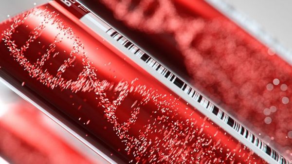 Liquid biopsies to better detect the spread of prostate cancer