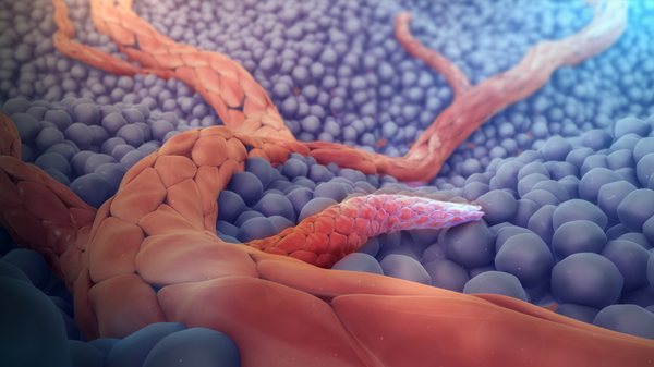 Cancer 101: Let there be blood – how cancer grows its own supply lines