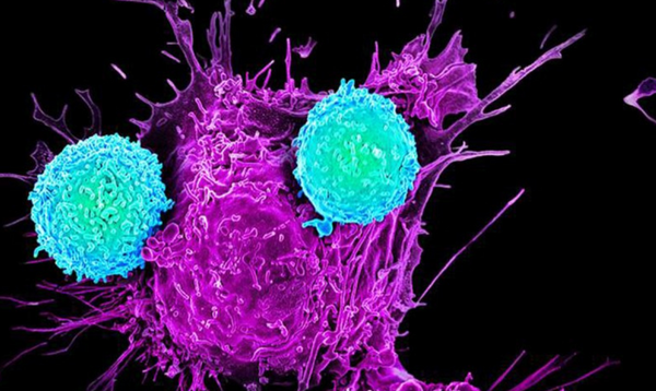 Immunity vs Cancer: Killer T cells