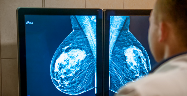 Cancer overdiagnosis – sending you to chemo when you don’t need it