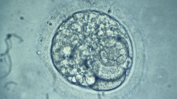 Does new reproductive technique mean embryos have 3 parents?