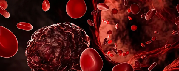 BiTE by BiTE: evolving blood cancer therapies