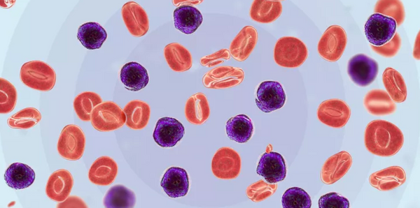 A Breakthrough for Acute Leukemia Patients!